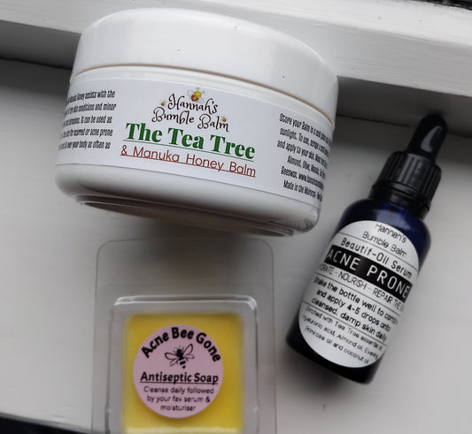 Acne Prone Starter Pack